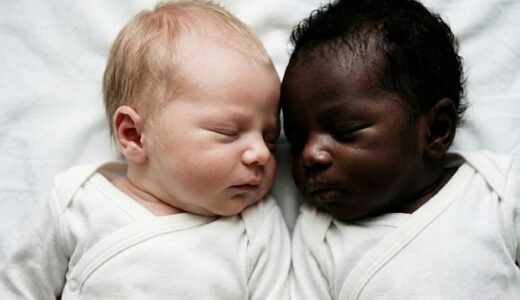 全く異なる見た目の双子。なぜこんなにも見た目が違うのか。その理由に衝撃を受ける。